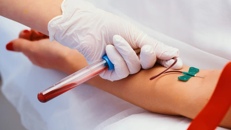 Lấy mẫu máu xét nghiệm diễn ra nhanh gọn, không cần nhịn ăn hay ngưng thuốc trước khi thực hiện