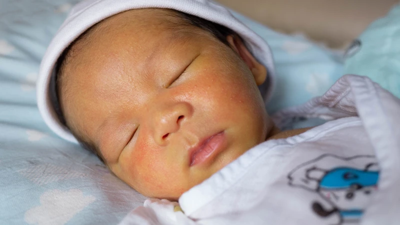 Sàng lọc sơ sinh giúp nhận biết bệnh trước triệu chứng, tránh biến chứng khi trẻ vàng da kéo dài