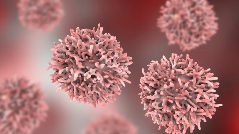 Sarcoma đa dạng không biệt hóa là dạng ung thư mô mềm hiếm gặp