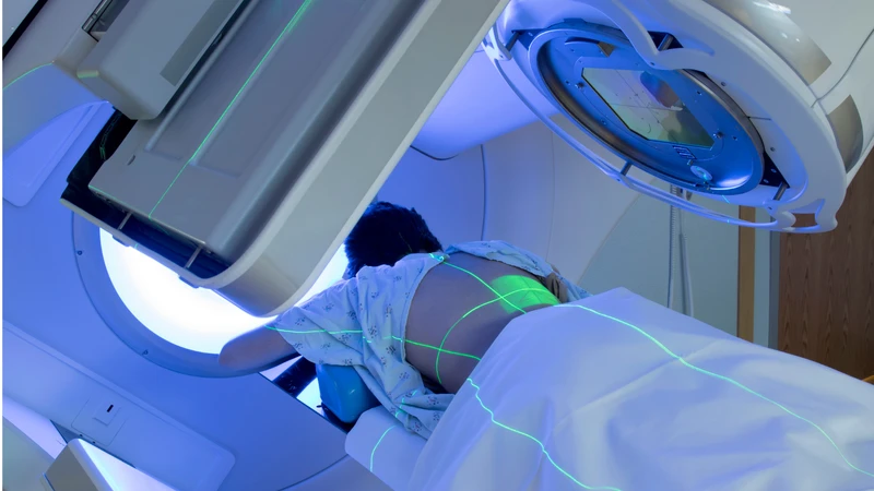 Điều trị sarcoma thường kết hợp phẫu thuật với xạ trị hoặc hóa trị tùy theo loại và giai đoạn bệnh