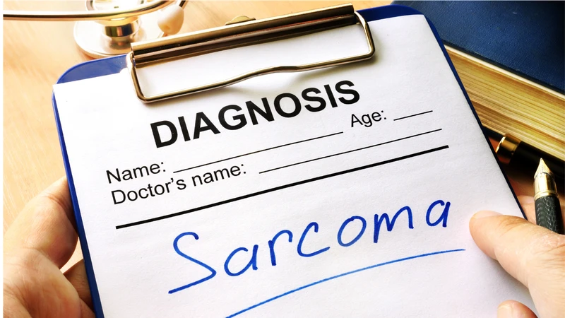Nhận biết sớm các dấu hiệu bất thường có thể hỗ trợ phát hiện sarcoma tử cung ở giai đoạn sớm