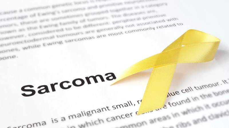 Sarcoma xơ bì lồi là khối u da hiếm gặp phát triển từ lớp trung bì