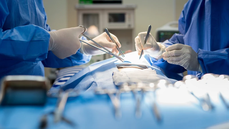 Điều trị sarcoma xơ bì lồi chủ yếu dựa vào phẫu thuật nhằm loại bỏ khối u và hạn chế nguy cơ tái phát