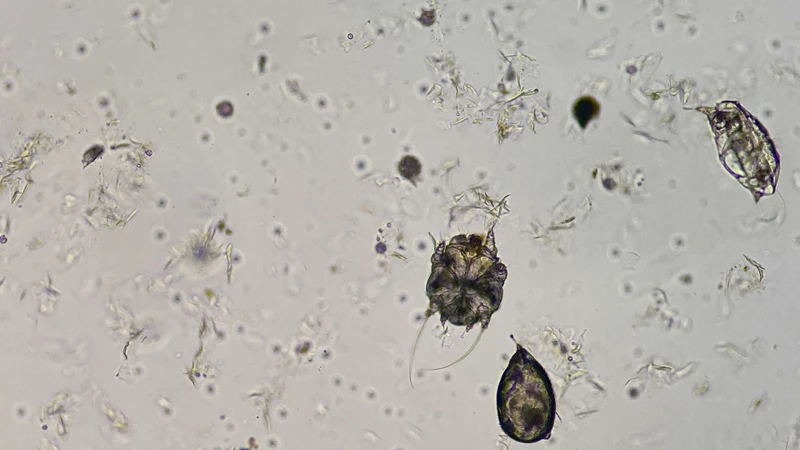 Sarcoptes scabiei là ký sinh trùng gây bệnh ghẻ trên da người