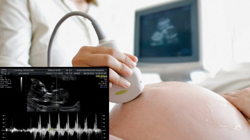 Khoảnh khắc nghe thấy tim thai là cột mốc hạnh phúc của các cặp đôi