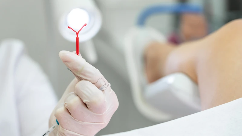 Rong kinh thường là phản ứng sinh lý khi tử cung thích nghi với dụng cụ tránh thai