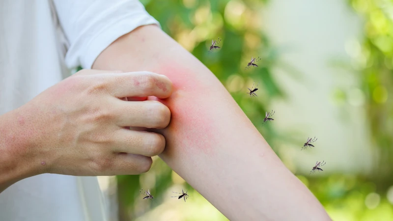 Sau khi bị muỗi đốt bao lâu bị sốt xuất huyết? 2