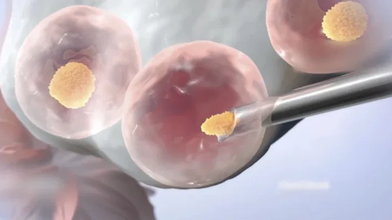 Chọc hút trứng xong hormone giảm dần, lớp nội mạc bong ra, cơ thể bước vào chu kỳ kinh nguyệt