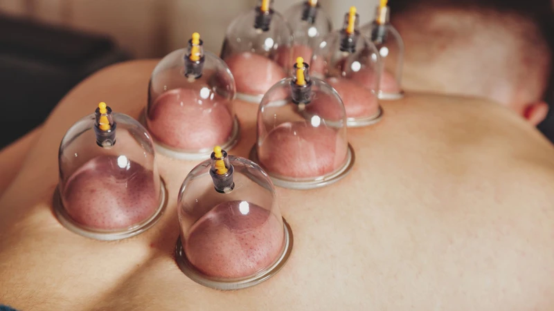 Sau khi giác hơi bao lâu thì được tắm là câu hỏi thắc mắc của nhiều người