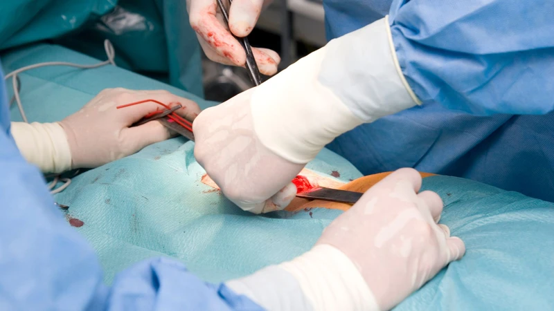 Người bị mất máu nhẹ sau phẫu thuật nên bổ sung đậu đen vào chế độ dinh dưỡng
