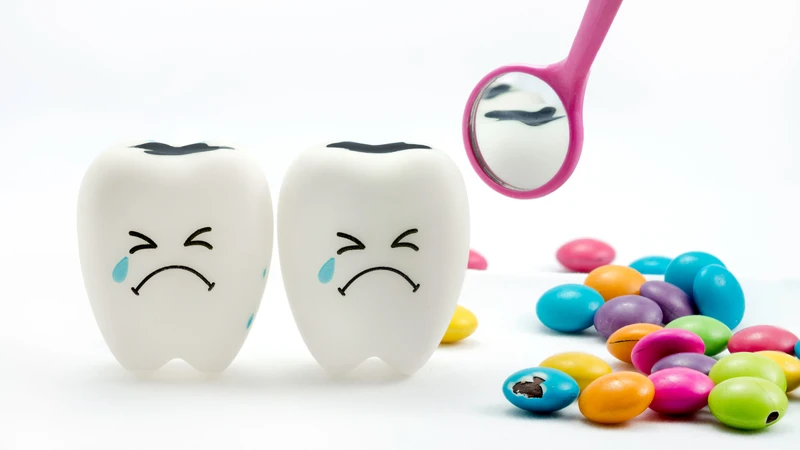 Sâu răng sữa thường do vi khuẩn tích tụ trong mảng bám răng gây ra