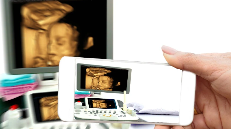 Siêu âm 4D thai 23 tuần cho phép ghi lại hình ảnh chuyển động của thai nhi theo thời gian thực