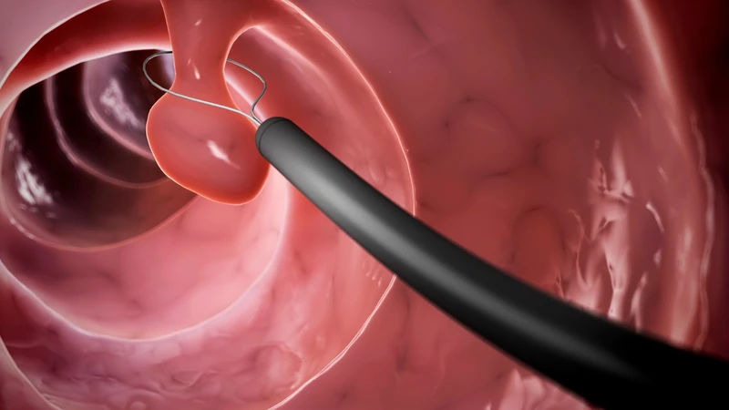 Siêu âm có thể phát hiện các khối u hoặc polyp