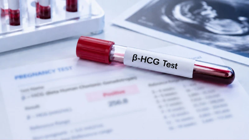 Bác sĩ có thể chỉ định xét nghiệm β-hCG định lượng để hỗ trợ theo dõi