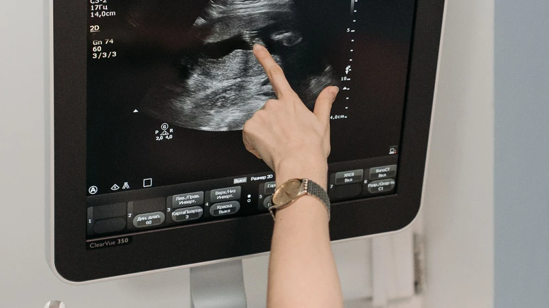 Siêu âm đầu dò: Phương pháp chẩn đoán hiệu quả trong sản phụ khoa và tiết niệu 2