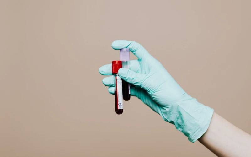 Nếu kết hợp siêu âm độ mờ da gáy với double test, NIPT test để cho kết quả chính xác nhất