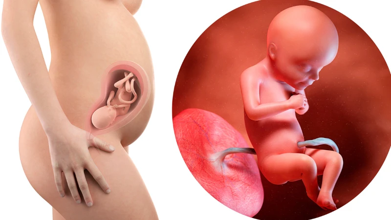 Siêu âm độ mờ da gáy: Cách nhận diện sớm nguy cơ dị tật bẩm sinh ở thai nhi 2