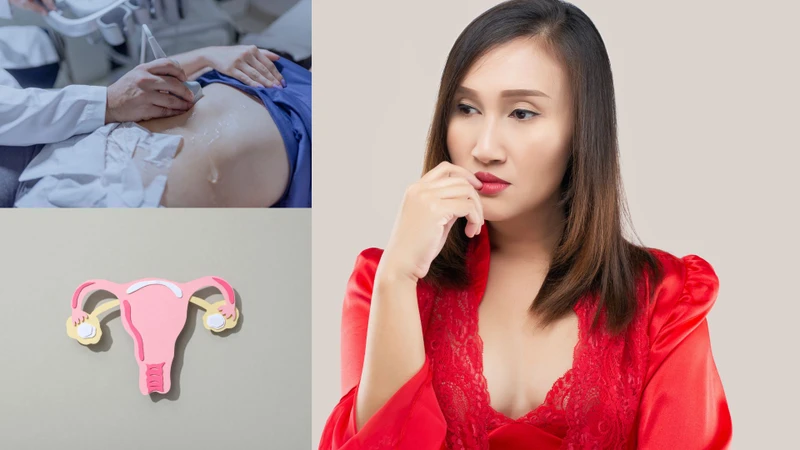 Siêu âm ổ bụng có phát hiện ung thư cổ tử cung không? Lời giải đáp từ phía chuyên gia 1