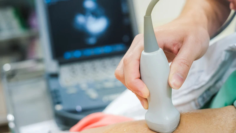 Siêu âm tim nên được thực hiện theo chỉ định và hướng dẫn của nhân viên y tế