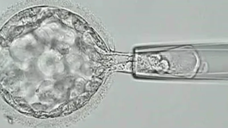 Sinh thiết phôi là kỹ thuật sàng lọc di truyền tiên tiến trong IVF