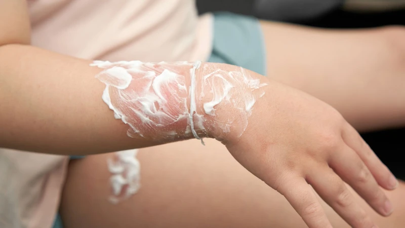 Sơ cứu vết thương ngoài da: Cách xử lý đúng và an toàn cho người bệnh 3