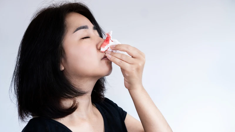 Sổ mũi ra máu có nguy hiểm không? Nguyên nhân và cách xử trí an toàn 1