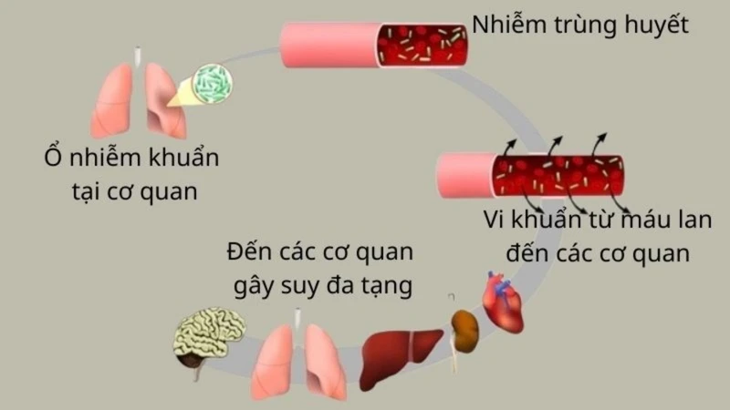 Soc-nhiem-trung-la-gi-nhung-dieu-can-biet-ve-soc-nhiem-trung2.jpg