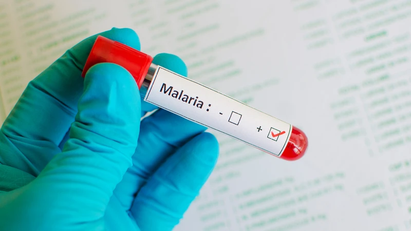 Việc xác định đúng loài Plasmodium giúp bác sĩ lựa chọn phác đồ điều trị phù hợp