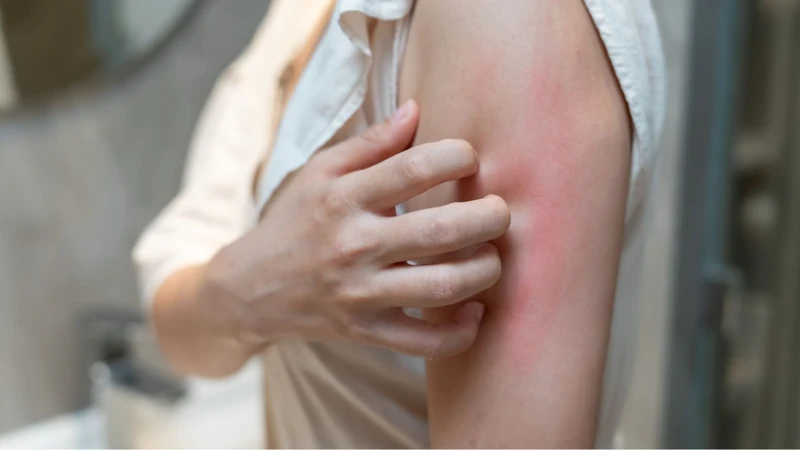 Sỏi mật gây tắc đường mật có thể dẫn đến tình trạng ngứa kéo dài