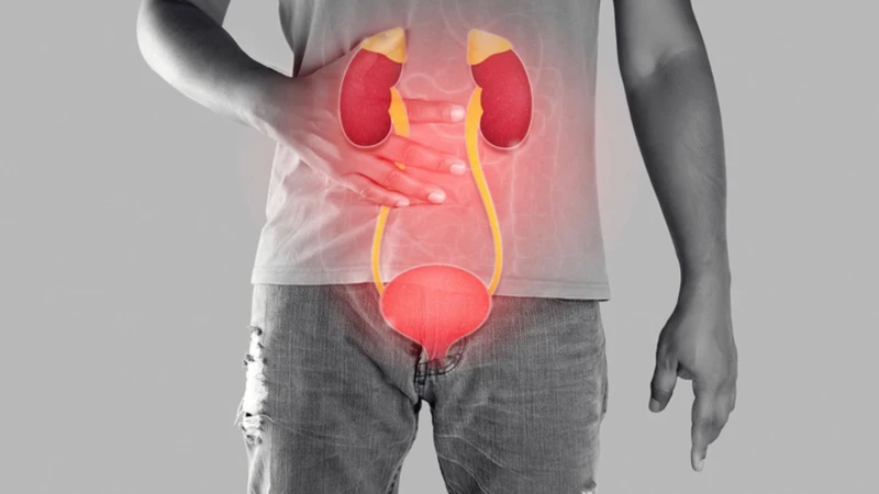 Sỏi niệu đạo và những điều cần biết để phòng tránh hiệu quả 1