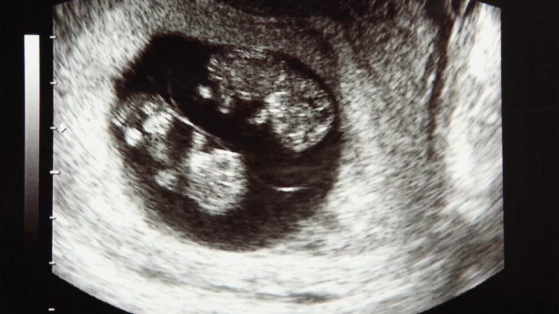 Qua các kỹ thuật hỗ trợ sinh sản hiện nay như IVF, kích trứng, tỷ lệ mang song thai có xu hướng gia tăng