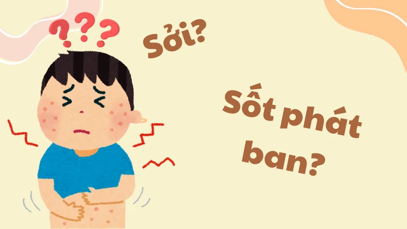 sot-phat-ban2.jpg