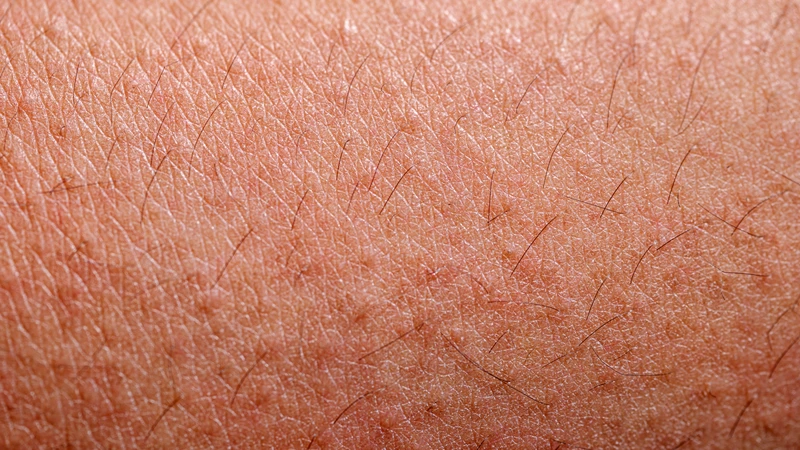 Kiêng gió sai cách có thể khiến người bệnh khó chịu hơn