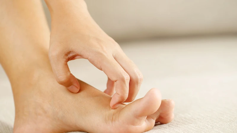 Sốt xuất huyết gây ngứa lòng bàn tay bàn chân có phải là triệu chứng phổ biến?-1