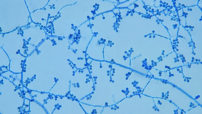 Sporothrix schenckii là loại nấm gây bệnh sporotrichosis, thường tồn tại trong đất, bụi hoa hồng và thực vật