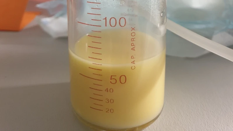 Sữa non chứa nhiều kháng thể và protein hơn sữa trưởng thành