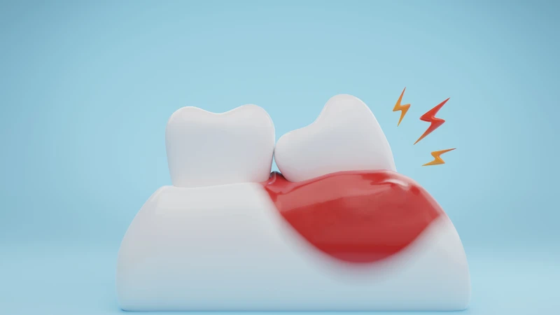 Sưng nướu răng khôn gây đau âm ỉ hoặc đau nhói tại vị trí răng số 8
