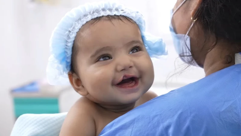 Sứt môi nhẹ có thể được điều trị hiệu quả bằng phẫu thuật chỉnh hình môi