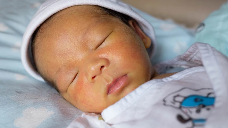 Vàng da kéo dài là một trong những biểu hiện sớm suy giáp bẩm sinh
