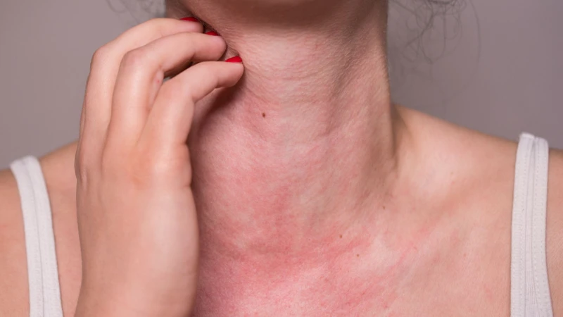 Tác hại của quả la hán đó là có thể gây dị ứng với một số người