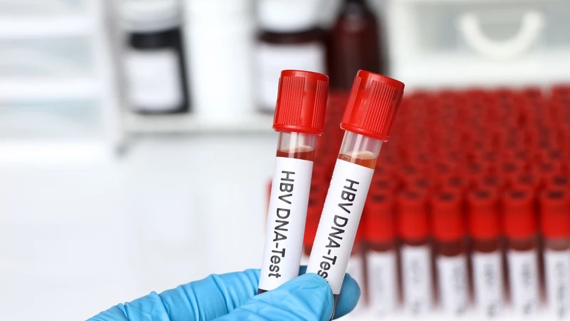 Tải lượng virus viêm gan b dưới ngưỡng phát hiện có ý nghĩa gì?