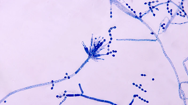 Talaromyces marneffei gây nhiễm trùng cơ hội, thường gặp ở người mắc AIDS và những người suy giảm miễn dịch
