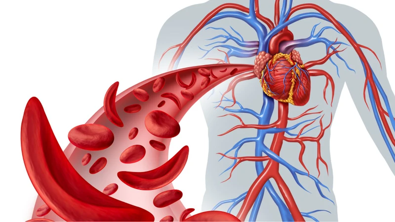 Những bất thường của hệ tĩnh mạch cần được phát hiện sớm để hạn chế nguy cơ ảnh hưởng đến tuần hoàn máu