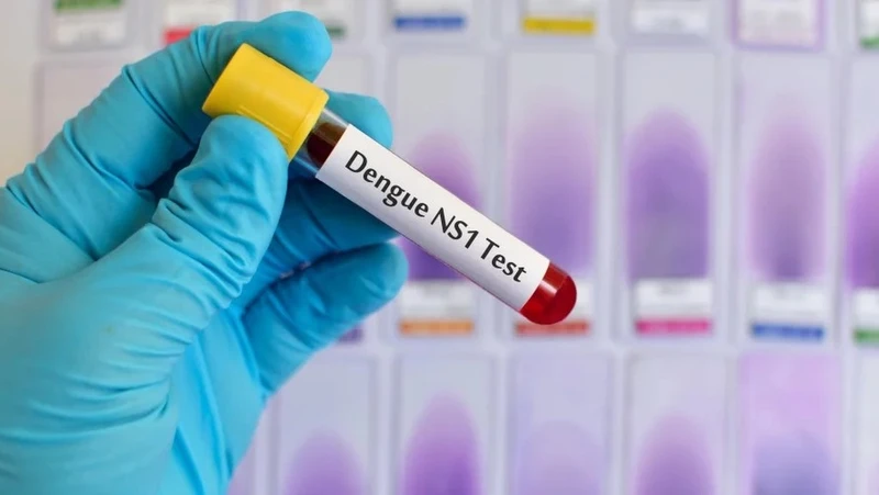 Test kháng nguyên là gì? Khi nào cần thực hiện xét nghiệm kháng nguyên 2