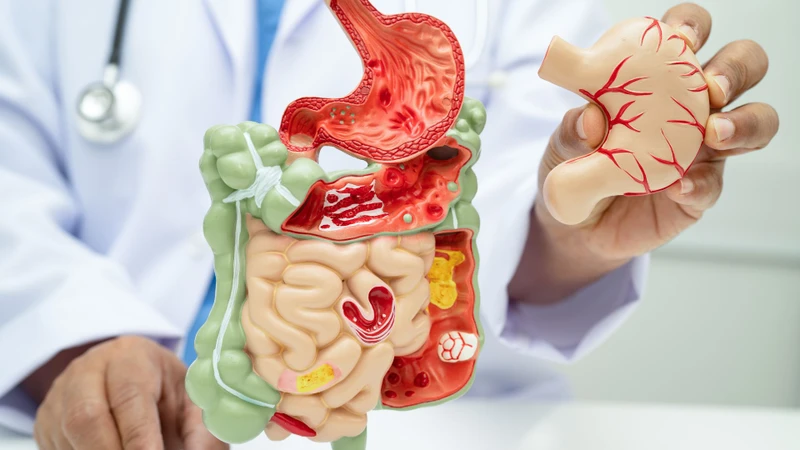Hệ tiêu hóa khỏe mạnh là khi người đó ăn ngon miệng, không thường xuyên gặp các vấn đề về tiêu hóa