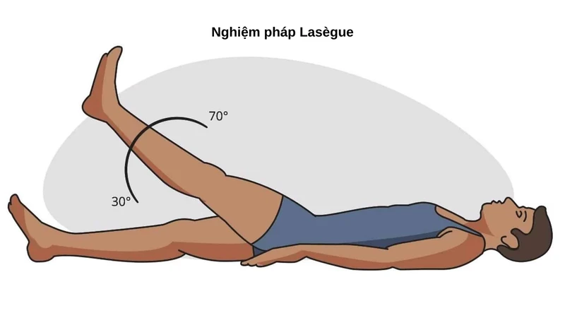 Thoái hóa cột sống là gì? Nguyên nhân, triệu chứng và điều trị 5