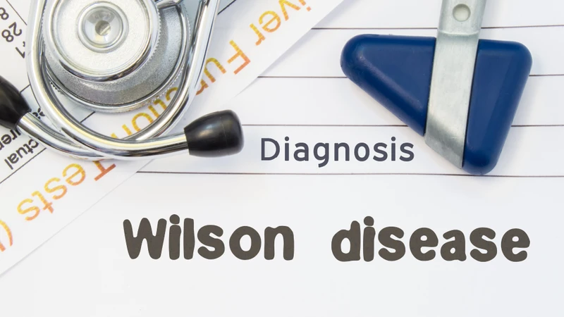 Bệnh Wilson cũng có thể ảnh hưởng đến khớp, làm tăng nguy cơ thoái hóa ở người trẻ tuổi