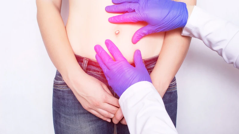Cách nhận biết thoát vị bẹn trực tiếp và gián tiếp qua khối phồng và vị trí