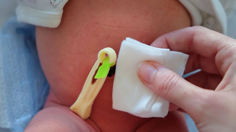 nguyên nhân chính xác gây thoát vị rốn ở thai nhi vẫn chưa được làm rõ