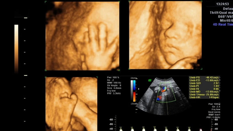 Siêu âm 4D giúp quan sát rõ nét các chuyển động và phản xạ của thai nhi